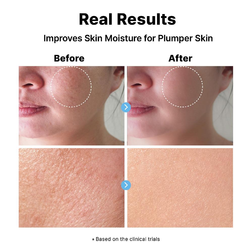 Dearmydew Hyaluronic acid 2% serum 120ml